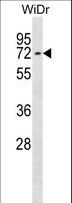 CTNNBL1 / NAP Antibody - CTNNBL1 Antibody western blot of WiDr cell line lysates (35 ug/lane). The CTNNBL1 antibody detected the CTNNBL1 protein (arrow).