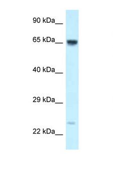 CTNNBL1 / NAP Antibody - CTNNBL1 antibody Western blot of Jurkat Cell lysate. Antibody concentration 1 ug/ml.  This image was taken for the unconjugated form of this product. Other forms have not been tested.