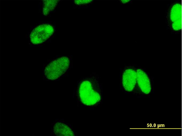 CTNNBL1 / NAP Antibody - Immunofluorescence of monoclonal antibody to CTNNBL1 on HeLa cell (antibody concentration 40 ug/ml).