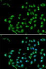 CTNNBL1 / NAP Antibody - Immunofluorescence analysis of U20S cells.