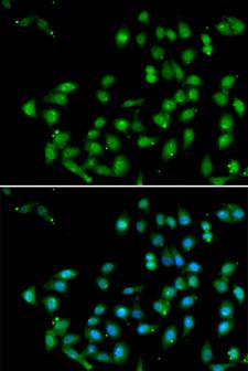 CTNNBL1 / NAP Antibody - Immunofluorescence analysis of U20S cells.