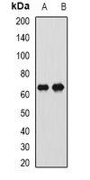 CTNNBL1 / NAP Antibody - Western blot analysis of CTNNBL1 expression in HeLa (A); SW620 (B) whole cell lysates.