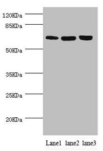 CTNNBL1 / NAP Antibody - Western blot All Lanes:CTNNBL1 antibody at 5.39ug/ml Lane 1:Hela whole cell lysate Lane 2:jurkat whole cell lysate Lane 3:293T whole cell lysate Secondary Goat polyclonal to rabbit at 1/10000 dilution Predicted band size: 66,44,37,62 kDa Observed band size: 65 kDa