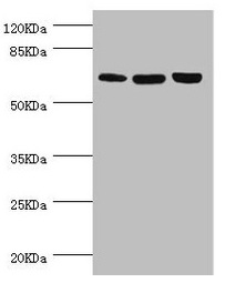 CTNNBL1 / NAP Antibody - Western blot All lanes: CTNNBL1 antibody at 5.39µg/ml Lane 1: Hela whole cell lysate Lane 2: Jurkat whole cell lysate Lane 3: 293T whole cell lysate Secondary Goat polyclonal to rabbit IgG at 1/10000 dilution Predicted band size: 66, 44, 37, 62 kDa Observed band size: 66 kDa