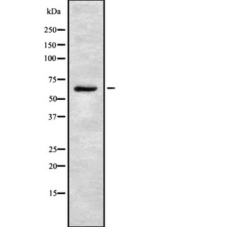 CTNNBL1 / NAP Antibody - Western blot analysis of CTNNBL1 using 293 whole lysates.