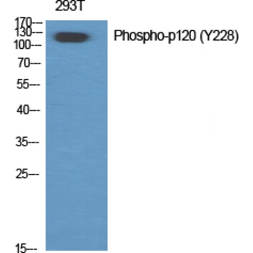 CTNND1 / p120 Catenin Antibody - Western blot of Phospho-p120 (Y228) antibody
