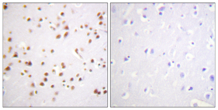CTNND1 / p120 Catenin Antibody - Immunohistochemistry analysis of paraffin-embedded human brain tissue, using Catenin-delta1 Antibody. The picture on the right is blocked with the synthesized peptide.