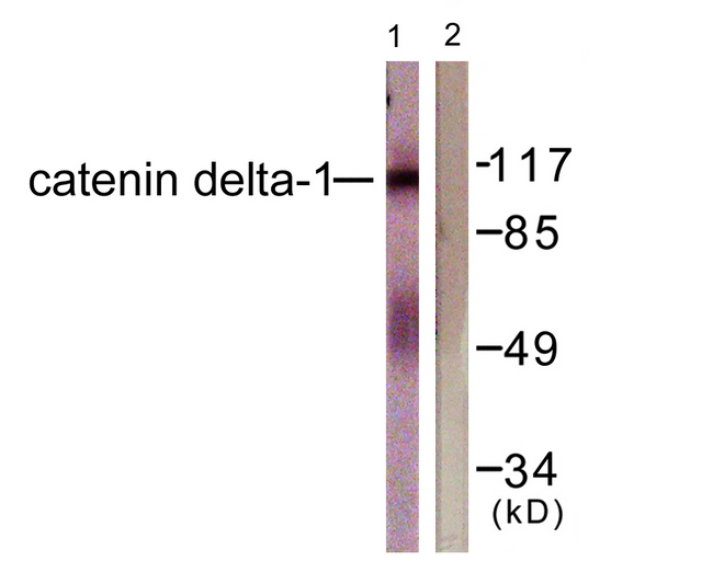 CTNND1 / p120 Catenin Antibody - Western blot analysis of lysates from HUVEC cells, using Catenin-delta1 Antibody. The lane on the right is blocked with the synthesized peptide.
