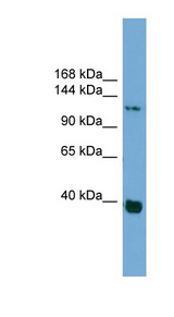 CTNND1 / p120 Catenin Antibody - CTNND1 / p120CTN antibody Western blot of HepG2 cell lysate. This image was taken for the unconjugated form of this product. Other forms have not been tested.