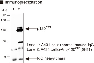 CTNND1 / p120 Catenin Antibody