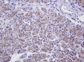 CTNND1 / p120 Catenin Antibody - IHC of paraffin-embedded Human pancreas tissue using anti-CTNND1 mouse monoclonal antibody. (Heat-induced epitope retrieval by 10mM citric buffer, pH6.0, 120°C for 3min).