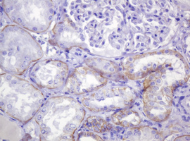 CTNND1 / p120 Catenin Antibody - IHC of paraffin-embedded Human Kidney tissue using anti-CTNND1 mouse monoclonal antibody. (Heat-induced epitope retrieval by 10mM citric buffer, pH6.0, 120°C for 3min).