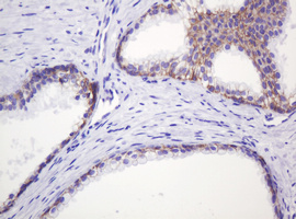 CTNND1 / p120 Catenin Antibody - IHC of paraffin-embedded Human prostate tissue using anti-CTNND1 mouse monoclonal antibody. (Heat-induced epitope retrieval by 10mM citric buffer, pH6.0, 120°C for 3min).