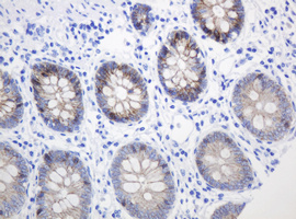 CTNND1 / p120 Catenin Antibody - IHC of paraffin-embedded Human colon tissue using anti-CTNND1 mouse monoclonal antibody. (Heat-induced epitope retrieval by 10mM citric buffer, pH6.0, 120°C for 3min).
