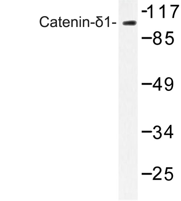 CTNND1 / p120 Catenin Antibody - Western blot of Catenin-1 (G224) pAb in extracts from HUVEC cells.