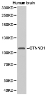 CTNND1 / p120 Catenin Antibody - Western blot of extracts of human brain cell lines, using CTNND1 antibody.
