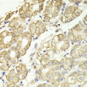 CTNND1 / p120 Catenin Antibody - Immunohistochemistry of paraffin-embedded Human gastric tissue.