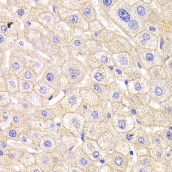 CTNND1 / p120 Catenin Antibody - Immunohistochemistry of paraffin-embedded Human liver tissue.