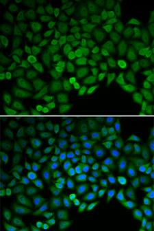 CTNND1 / p120 Catenin Antibody - Immunofluorescence analysis of HeLa cells.