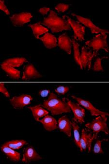 CTNND1 / p120 Catenin Antibody - Immunofluorescence analysis of U2OS cells using CTNND1 antibody. Blue: DAPI for nuclear staining.