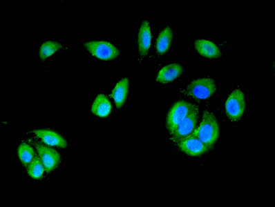 CTNND1 / p120 Catenin Antibody - Immunofluorescent analysis of A549 cells at a dilution of 1:100 and Alexa Fluor 488-congugated AffiniPure Goat Anti-Rabbit IgG(H+L)