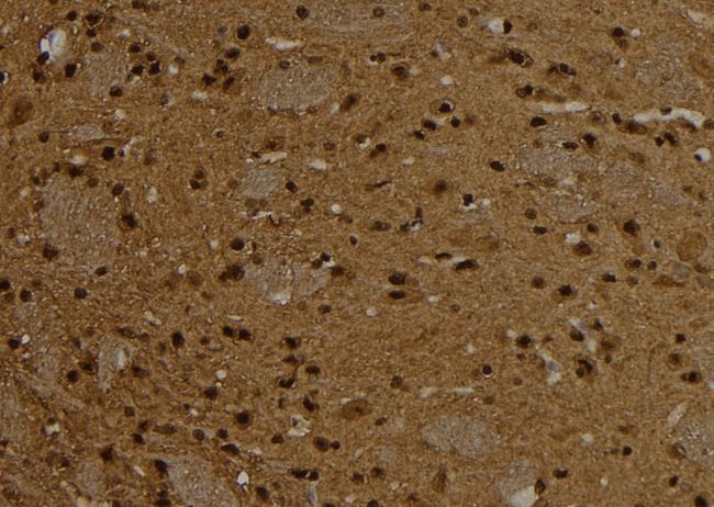 CTNND1 / p120 Catenin Antibody - 1:100 staining rat brain tissue by IHC-P. The sample was formaldehyde fixed and a heat mediated antigen retrieval step in citrate buffer was performed. The sample was then blocked and incubated with the antibody for 1.5 hours at 22°C. An HRP conjugated goat anti-rabbit antibody was used as the secondary.