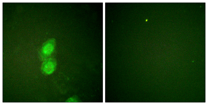 CTNND1 / p120 Catenin Antibody - Immunofluorescence analysis of HUVEC cells, using Catenin-delta1 (Phospho-Tyr228) Antibody. The picture on the right is blocked with the phospho peptide.