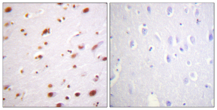 CTNND1 / p120 Catenin Antibody - Immunohistochemistry analysis of paraffin-embedded human brain, using Catenin-delta1 (Phospho-Tyr228) Antibody. The picture on the right is blocked with the phospho peptide.