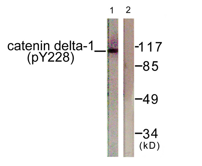 CTNND1 / p120 Catenin Antibody - Western blot analysis of lysates from HUVEC cells, using Catenin-delta1 (Phospho-Tyr228) Antibody. The lane on the right is blocked with the phospho peptide.