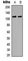 CTNND1 / p120 Catenin Antibody - Western blot analysis of Catenin delta 1 (pY228) expression in HEK293T (A); A431 (B) whole cell lysates.