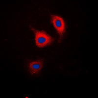 CTNND1 / p120 Catenin Antibody - Immunofluorescent analysis of Catenin delta 1 (pY228) staining in HEK293T cells. Formalin-fixed cells were permeabilized with 0.1% Triton X-100 in TBS for 5-10 minutes and blocked with 3% BSA-PBS for 30 minutes at room temperature. Cells were probed with the primary antibody in 3% BSA-PBS and incubated overnight at 4 ??C in a humidified chamber. Cells were washed with PBST and incubated with a DyLight 594-conjugated secondary antibody (red) in PBS at room temperature in the dark. DAPI was used to stain the cell nuclei (blue).