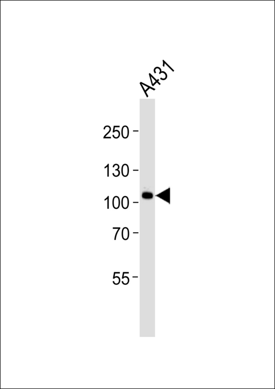 CTNND1 / p120 Catenin Antibody - Western blot of lysate from A431 cell line with HUMAN-CTNND1_isform 2ABC (Y174). Antibody was diluted at 1:1000. A goat anti-rabbit IgG H&L (HRP) at 1:5000 dilution was used as the secondary antibody. Lysate at 35 ug.