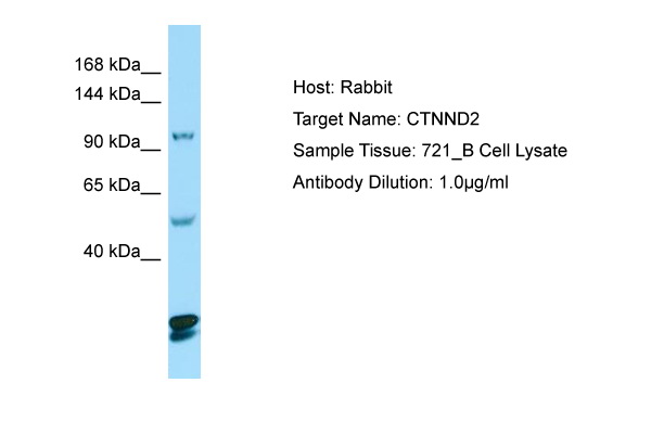 CTNND2 / Delta-2 Catenin Antibody -  This image was taken for the unconjugated form of this product. Other forms have not been tested.