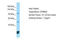 CTNND2 / Delta-2 Catenin Antibody -  This image was taken for the unconjugated form of this product. Other forms have not been tested.