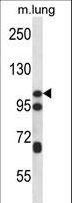 CTNND2 / Delta-2 Catenin Antibody - CTNND2 Antibody western blot of mouse lung tissue lysates (35 ug/lane). The CTNND2 antibody detected the CTNND2 protein (arrow).