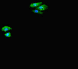 CTNND2 / Delta-2 Catenin Antibody - Immunofluorescent analysis of HepG-2 cells diluted at 1:100 and Alexa Fluor 488-congugated AffiniPure Goat Anti-Rabbit IgG(H+L)