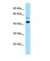CTNS / Cystinosin Antibody - Western blot of Ctns Antibody - middle region in Mouse Lung cells lysate.  This image was taken for the unconjugated form of this product. Other forms have not been tested.
