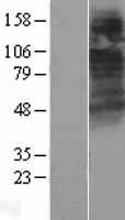 CTNS / Cystinosin Protein - Western validation with an anti-DDK antibody * L: Control HEK293 lysate R: Over-expression lysate