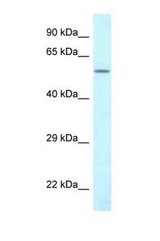 CTP Synthetase 2 / CTPS2 Antibody - CTPS2 antibody Western blot of HeLa Cell lysate. Antibody concentration 1 ug/ml.  This image was taken for the unconjugated form of this product. Other forms have not been tested.