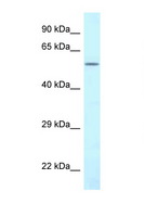 CTP Synthetase 2 / CTPS2 Antibody - CTPS2 antibody Western blot of HeLa Cell lysate. Antibody concentration 1 ug/ml.  This image was taken for the unconjugated form of this product. Other forms have not been tested.