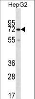 CTP Synthetase 2 / CTPS2 Antibody - CTPS2 Antibody western blot of HepG2 cell line lysates (35 ug/lane). The CTPS2 antibody detected the CTPS2 protein (arrow).