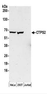 CTP Synthetase 2 / CTPS2 Antibody - Detection of Human CTPS2 by Western Blot. Samples: Whole cell lysate (50 ug) prepared using NETN buffer from HeLa, 293T, and Jurkat cells. Antibodies: Affinity purified rabbit anti-CTPS2 antibody used for WB at 0.4 ug/ml. Detection: Chemiluminescence with an exposure time of 3 minutes.