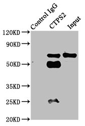 CTP Synthetase 2 / CTPS2 Antibody - Immunoprecipitating CTPS2 in HepG2 whole cell lysate Lane 1: Rabbit control IgG instead of CTPS2 Antibody in HepG2 whole cell lysate.For western blotting, a HRP-conjugated Protein G antibody was used as the secondary antibody (1/2000) Lane 2: CTPS2 Antibody (6µg) + HepG2 whole cell lysate (500µg) Lane 3: HepG2 whole cell lysate (20µg)