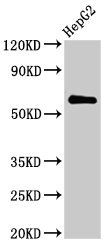 CTP Synthetase 2 / CTPS2 Antibody - Western Blot Positive WB detected in: HepG2 whole cell lysate All lanes: CTPS2 antibody at 2.8µg/ml Secondary Goat polyclonal to rabbit IgG at 1/50000 dilution Predicted band size: 66 kDa Observed band size: 66 kDa