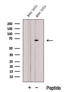 CTP Synthetase 2 / CTPS2 Antibody - Western blot analysis of extracts of HeLa cells using CTPS2 antibody. The lane on the left was treated with blocking peptide.