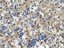 CTPS Antibody - CTPS antibody CTPS(CTP synthase) Antibody was used in IHC to stain formalin-fixed, paraffin-embedded human liver.  This image was taken for the unconjugated form of this product. Other forms have not been tested.