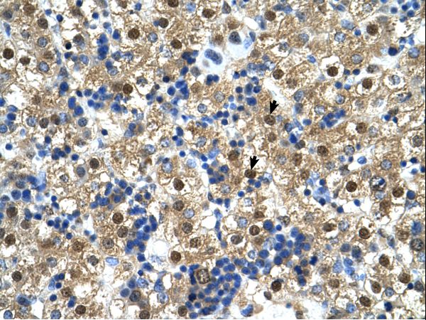 CTPS Antibody - CTPS antibody CTPS(CTP synthase) Antibody was used in IHC to stain formalin-fixed, paraffin-embedded human liver.  This image was taken for the unconjugated form of this product. Other forms have not been tested.