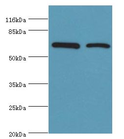 CTPS Antibody - Western blot. All lanes: CTPS1 antibody at 6 ug/ml. Lane 1: HeLa cells Lane 2: 293T cells. Secondary antibody: goat polyclonal to rabbit at 1:10000 dilution. Predicted band size: 67 kDa. Observed band size: 67 kDa.  This image was taken for the unconjugated form of this product. Other forms have not been tested.