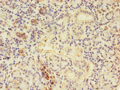 CTPS Antibody - Immunohistochemistry of paraffin-embedded human pancreatic tissue using CTPS1 Antibody at dilution of 1:100