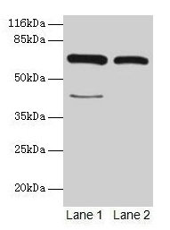 CTPS Antibody - Western blot All lanes: CTPS1 antibody at 6µg/ml Lane 1: Hela cells Lane 2: 293T cells Secondary Goat polyclonal to rabbit IgG at 1/10000 dilution Predicted band size: 67, 42 kDa Observed band size: 67 kDa
